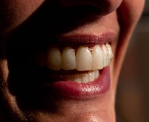 ortodoncia OLYMPUS DIGITAL CAMERA